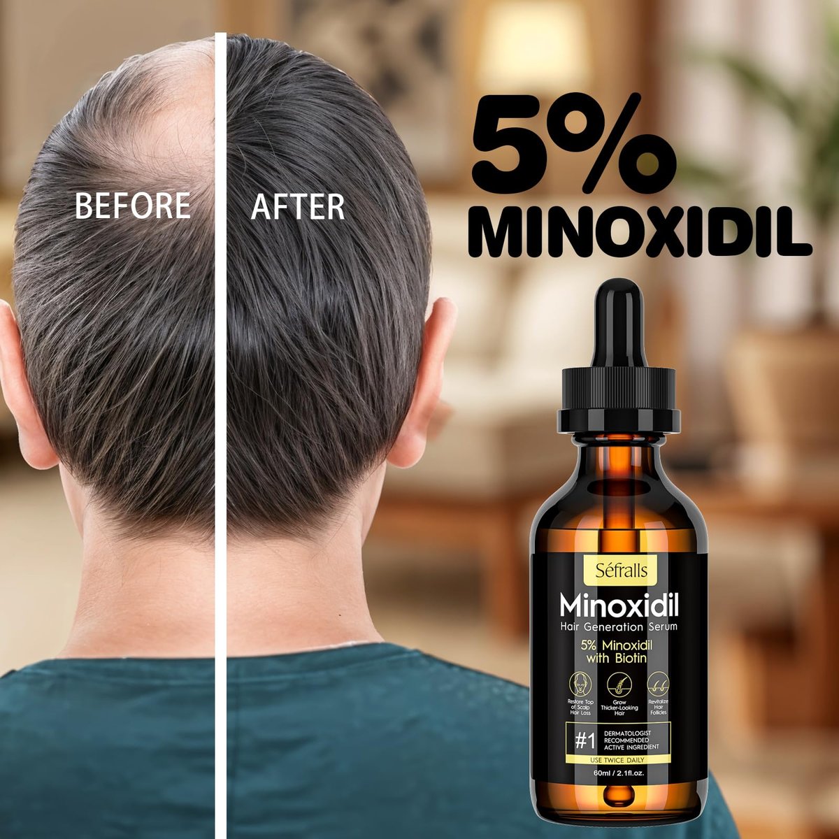 5% Minoxidil Hair Growth Serum for Men and Women - Biotin Hair Serum, Safe Hair Regrowth Treatment, Prevent Scalp Hair Loss, 60ml / 2.11 fl.oz - görsel 12