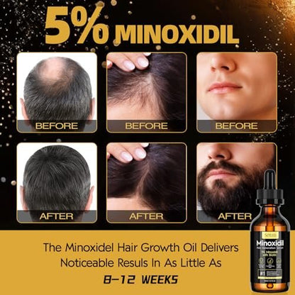 5% Minoxidil Hair Growth Serum for Men and Women - Biotin Hair Serum, Safe Hair Regrowth Treatment, Prevent Scalp Hair Loss, 60ml / 2.11 fl.oz