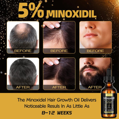 5% Minoxidil Hair Growth Serum for Men and Women - Biotin Hair Serum, Safe Hair Regrowth Treatment, Prevent Scalp Hair Loss, 60ml / 2.11 fl.oz