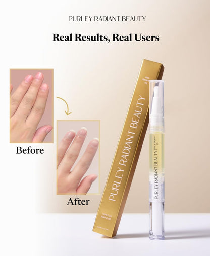 Purely Radiant Beauty Nail Growth Oil – Natural Cuticle Serum for Stronger Nails & Healthy Growth | Jojoba, Castor, Coconut & Argan Oils | Prevents Breakage, Peeling & Brittleness (3ml)
