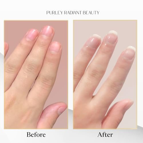 Purely Radiant Beauty Nail Growth Oil – Natural Cuticle Serum for Stronger Nails & Healthy Growth | Jojoba, Castor, Coconut & Argan Oils | Prevents Breakage, Peeling & Brittleness (3ml) - görsel 16