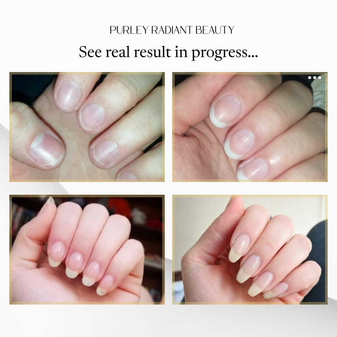 Purely Radiant Beauty Nail Growth Oil – Natural Cuticle Serum for Stronger Nails & Healthy Growth | Jojoba, Castor, Coconut & Argan Oils | Prevents Breakage, Peeling & Brittleness (3ml) - görsel 7