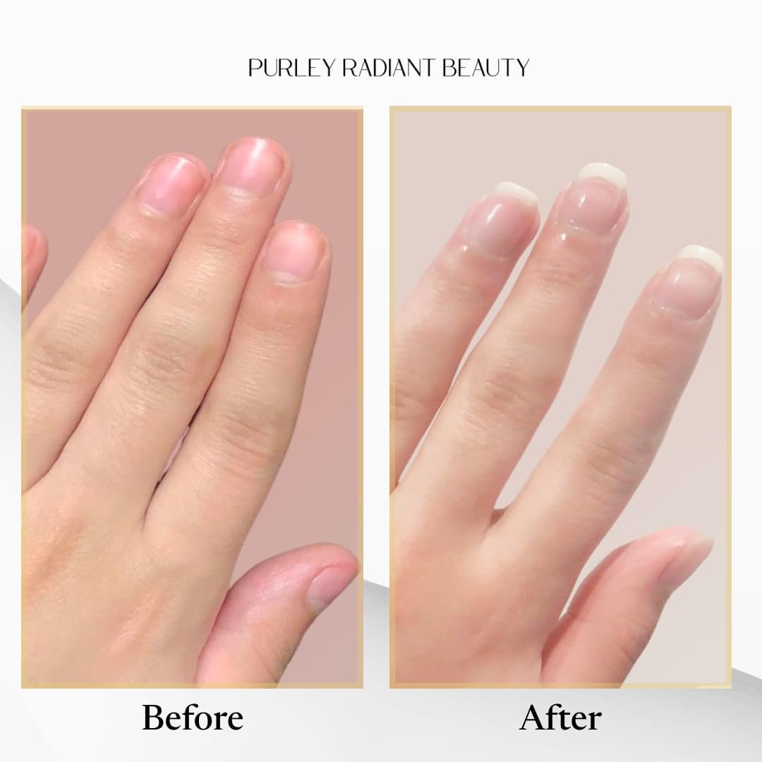 Purely Radiant Beauty Nail Growth Oil – Natural Cuticle Serum for Stronger Nails & Healthy Growth | Jojoba, Castor, Coconut & Argan Oils | Prevents Breakage, Peeling & Brittleness (3ml) - görsel 15