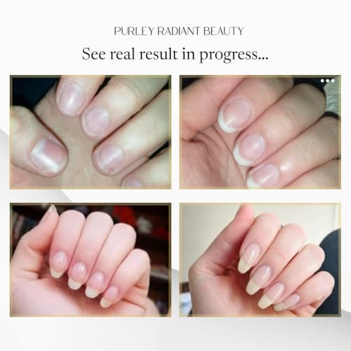Purely Radiant Beauty Nail Growth Oil – Natural Cuticle Serum for Stronger Nails & Healthy Growth | Jojoba, Castor, Coconut & Argan Oils | Prevents Breakage, Peeling & Brittleness (3ml) - görsel 8