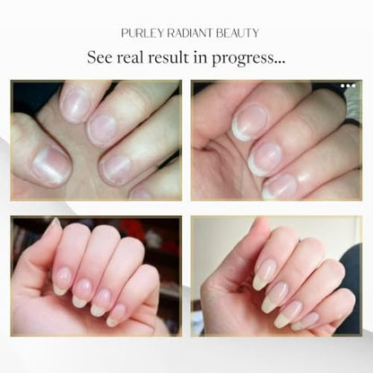Purely Radiant Beauty Nail Growth Oil – Natural Cuticle Serum for Stronger Nails & Healthy Growth | Jojoba, Castor, Coconut & Argan Oils | Prevents Breakage, Peeling & Brittleness (3ml)