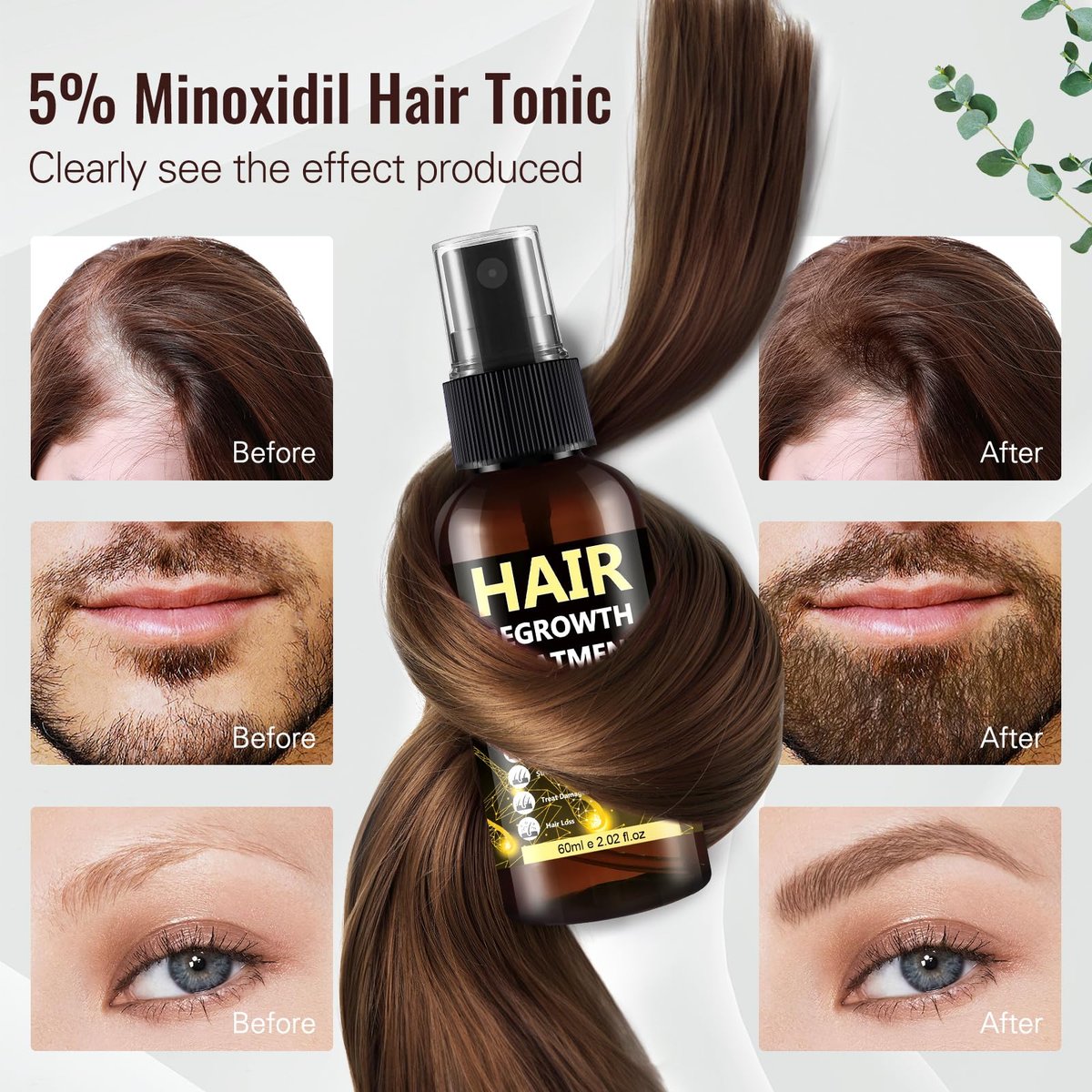 5% Minoxidil Hair Regrowth Spray for Men & Women – Advanced Formula for Thinning Hair and Beard Growth (3-Pack, 2.04 Fl Oz Each) Avelisse