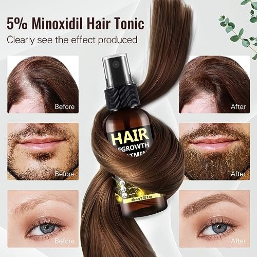 5% Minoxidil Hair Regrowth Spray for Men & Women – Advanced Formula for Thinning Hair and Beard Growth (3-Pack, 2.04 Fl Oz Each) Avelisse