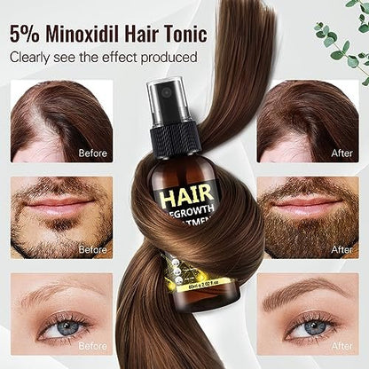5% Minoxidil Hair Regrowth Spray for Men & Women – Advanced Formula for Thinning Hair and Beard Growth (3-Pack, 2.04 Fl Oz Each) Avelisse