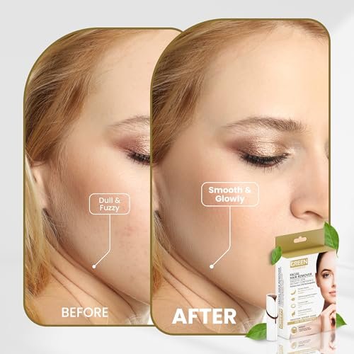 Gentle Facial Hair Remover for Women – Painless Peach Fuzz, Lip & Chin Hair Removal – USB Rechargeable Epilator Avelisse