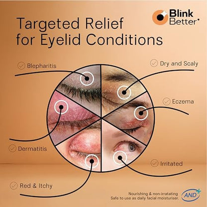 BlinkBetter BetterLids Restore Eyelid Cream – Hydrating Barrier Support for Dry, Itchy, Red & Sensitive Eyelids – Lightweight Daily Formula with 3% Oat & Ceramides, 1 fl oz