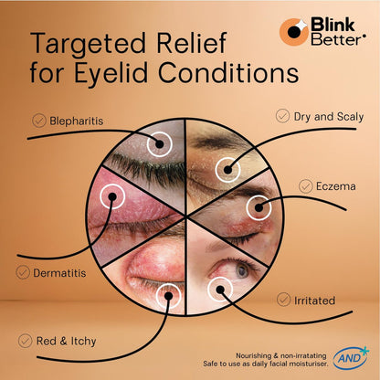 BlinkBetter BetterLids Restore Eyelid Cream – Hydrating Barrier Support for Dry, Itchy, Red & Sensitive Eyelids – Lightweight Daily Formula with 3% Oat & Ceramides, 1 fl oz