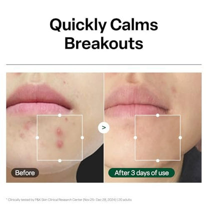 Dr. G R.E.D. Blemish Clear Hyal-Cica Soothing Serum – Korean Hydrating Serum with Hyaluronic Acid & Centella Asiatica for All Skin Types, 1.69 fl oz Avelisse