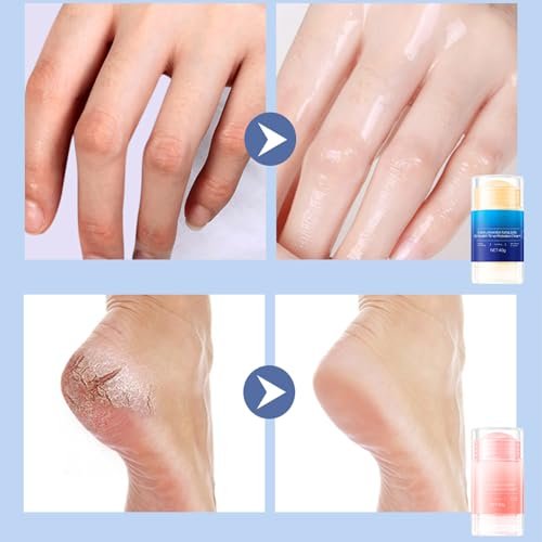 HJXUQIME Feet Cracking Prevention Stick - Anti-Cracking Foot & Hand Cream Moisturizer for Dry Cracked Heel, Knee, Elbow - Callus Remover & Dead Skin Softener (2-Pack, Pink+Blue) - görsel 4