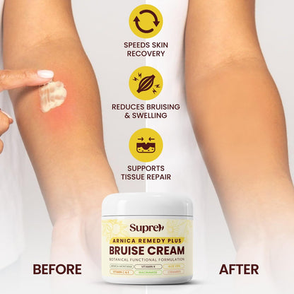 SupreH Arnica Bruise Cream Extra Strength with Vitamin K, C, E, Niacinamide & Ceramide for Bruising, Swelling, Discoloration & Thin Skin - 1 oz Avelisse
