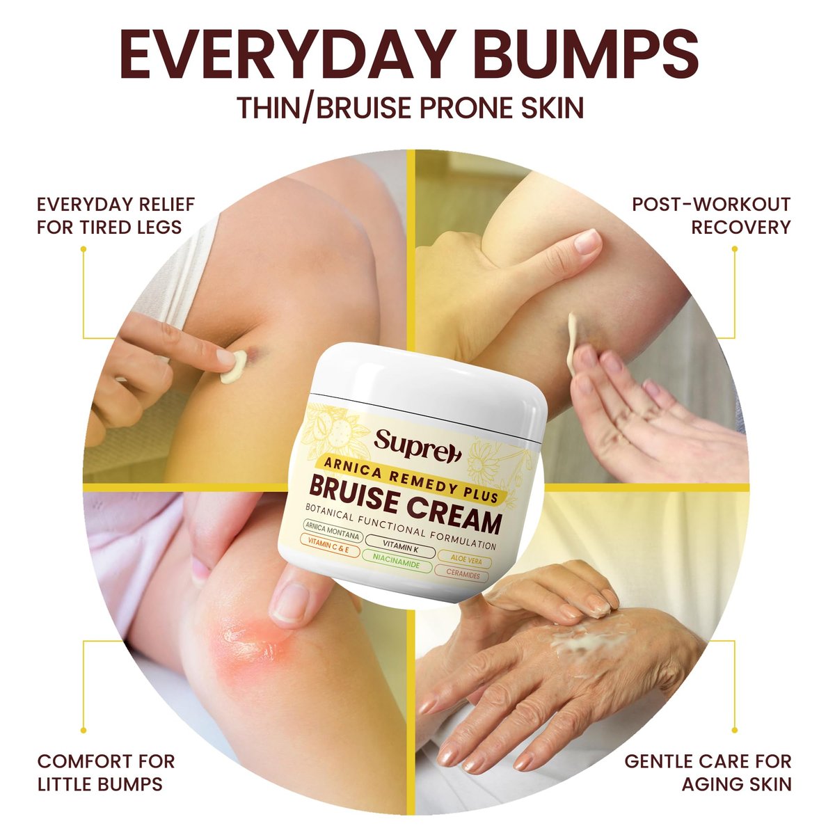 SupreH Arnica Bruise Cream Extra Strength with Vitamin K, C, E, Niacinamide & Ceramide for Bruising, Swelling, Discoloration & Thin Skin - 1 oz Avelisse
