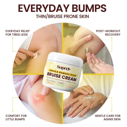 SupreH Arnica Bruise Cream Extra Strength with Vitamin K, C, E, Niacinamide & Ceramide for Bruising, Swelling, Discoloration & Thin Skin - 1 oz Avelisse