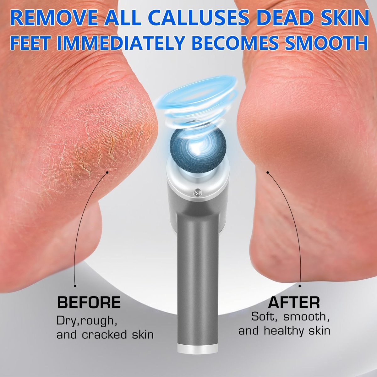 Upgraded Electric Callus Remover for Feet 4500rpm - Professional Foot Sander Pedicure File with 2 Interchangeable Heads and Replaceable Sandpaper Discs Avelisse