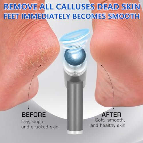 Upgraded Electric Callus Remover for Feet 4500rpm - Professional Foot Sander Pedicure File with 2 Interchangeable Heads and Replaceable Sandpaper Discs Avelisse