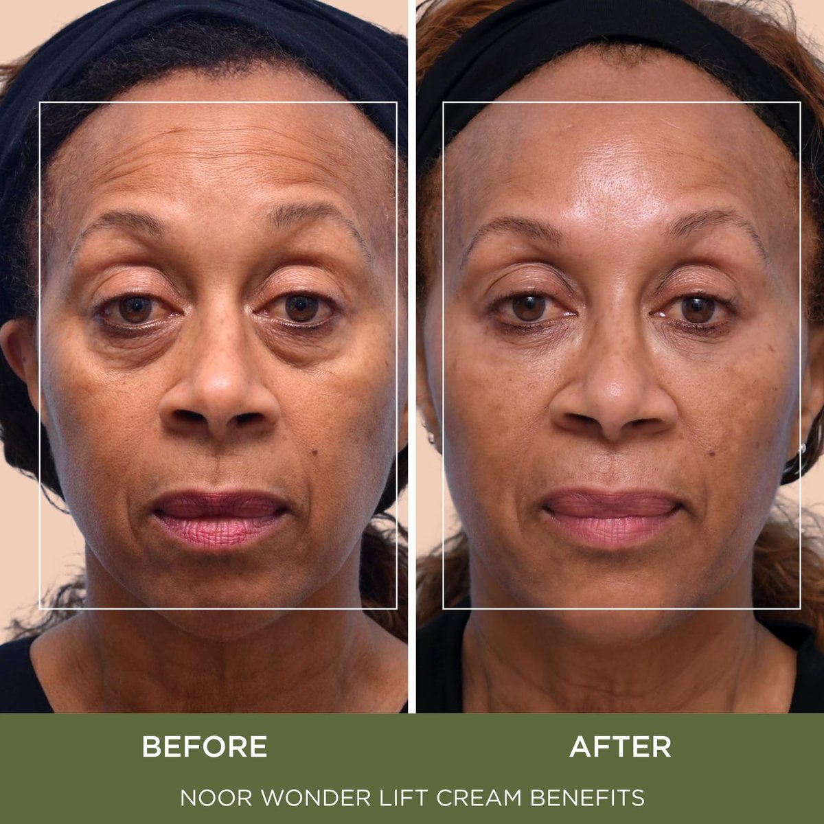 Noor Wonder Lift Cream for Women - Natural Anti-Aging Wrinkle Treatment with Syn-Ake Blend, 1 Fl Oz Avelisse