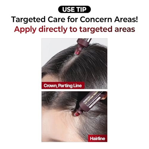 KUNDAL Hair Loss Serum Roll-on 10X Caffeine for Stronger Roots | Cooling Menthol & Botanical Hair Regrowth | Korean Scalp Wellness Care for Thinning Hair (0.33 fl oz) Avelisse