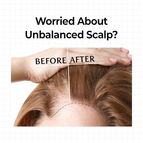 KUNDAL Hair Loss Serum Roll-on 10X Caffeine for Stronger Roots | Cooling Menthol & Botanical Hair Regrowth | Korean Scalp Wellness Care for Thinning Hair (0.33 fl oz) Avelisse
