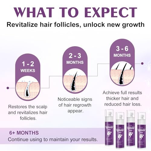 5% Minoxidil Spray for Women - 4 Pack, Hair Regrowth Treatment with Biotin, Supports Thicker & Fuller Hair (13oz, 7 Month Supply) Avelisse
