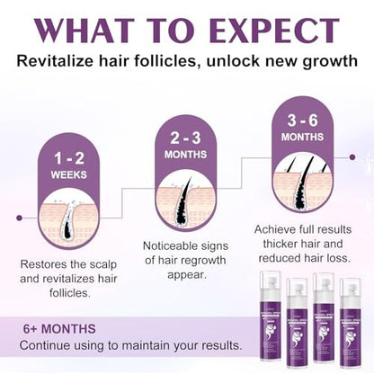5% Minoxidil Spray for Women - 4 Pack, Hair Regrowth Treatment with Biotin, Supports Thicker & Fuller Hair (13oz, 7 Month Supply) Avelisse
