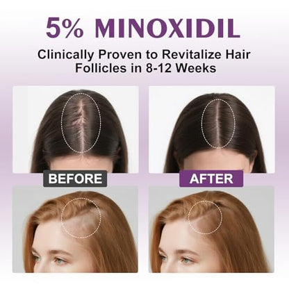 5% Minoxidil Spray for Women - 4 Pack, Hair Regrowth Treatment with Biotin, Supports Thicker & Fuller Hair (13oz, 7 Month Supply) Avelisse
