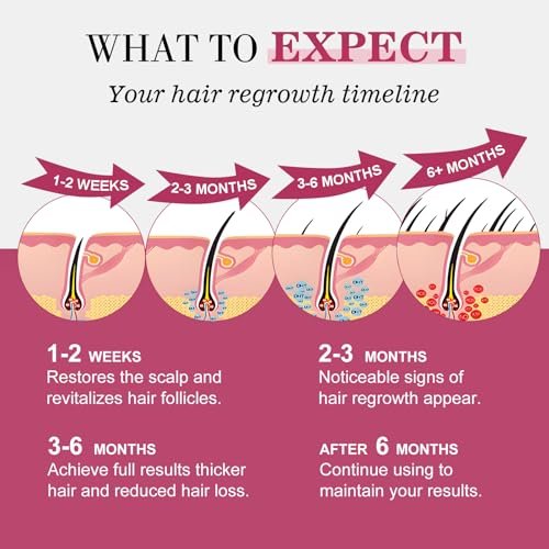 5% Minoxidil Hair Regrowth Spray for Women with Biotin – Extra Strength Treatment for Hair Loss and Thinning (3 Bottles) Avelisse