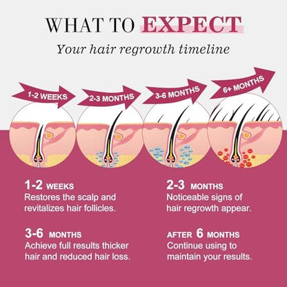 5% Minoxidil Hair Regrowth Spray for Women with Biotin – Extra Strength Treatment for Hair Loss and Thinning (3 Bottles) Avelisse