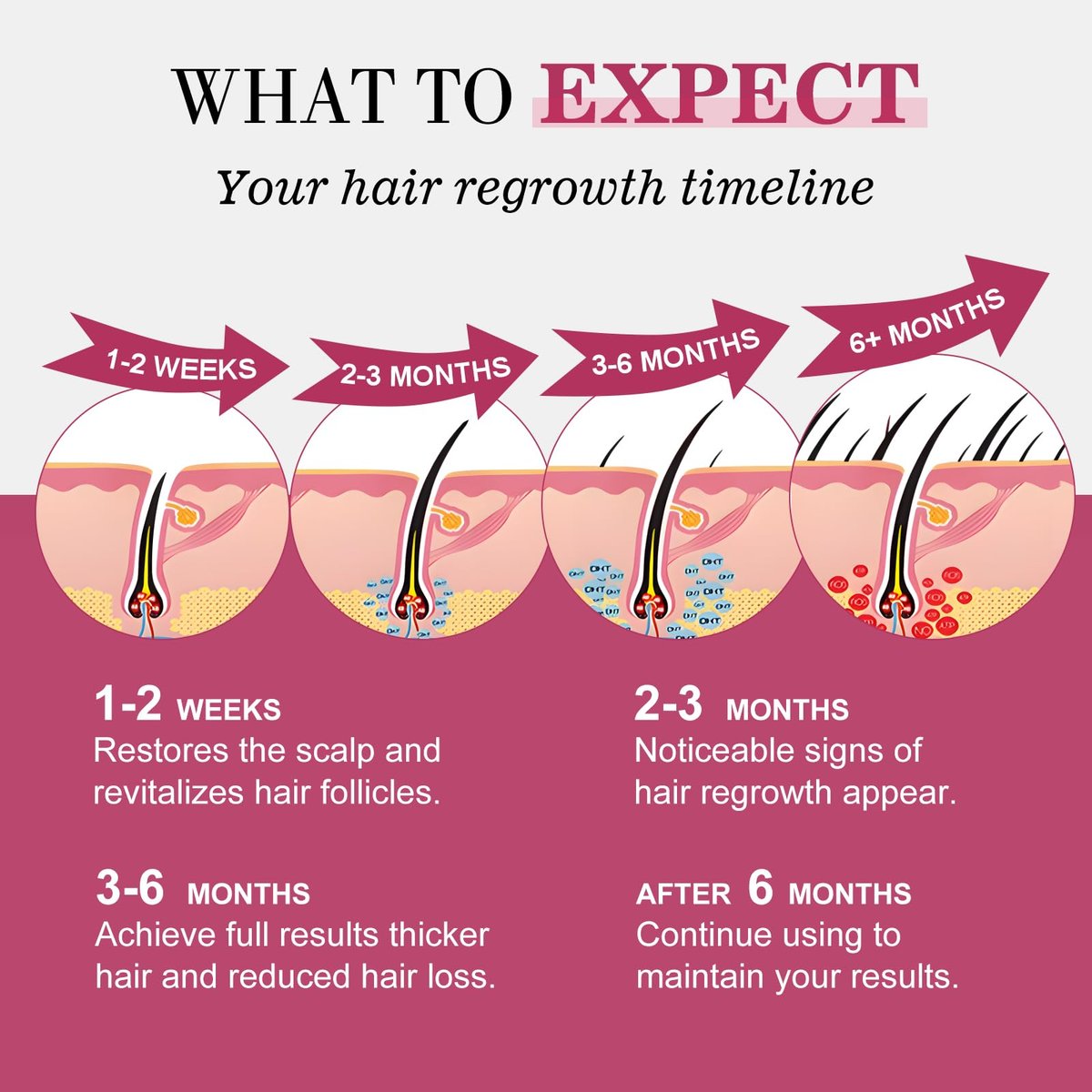 5% Minoxidil Hair Regrowth Spray for Women with Biotin – Extra Strength Treatment for Hair Loss and Thinning (3 Bottles) Avelisse