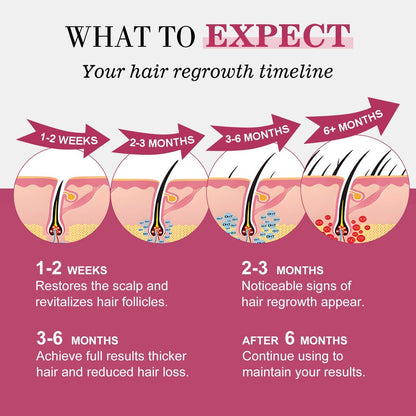 5% Minoxidil Hair Regrowth Spray for Women with Biotin – Extra Strength Treatment for Hair Loss and Thinning (3 Bottles) Avelisse