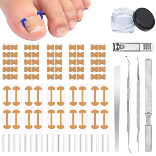 Ingrown Toenail Corrector Set with Correction Strips - Professional Pedicure Tool for Men and Women - görsel 2