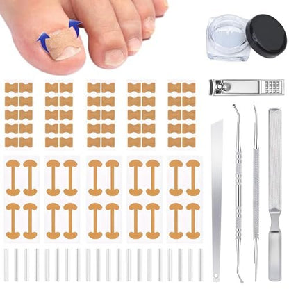 Ingrown Toenail Corrector Set with Correction Strips - Professional Pedicure Tool for Men and Women