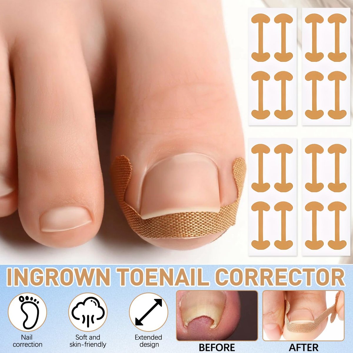 Ingrown Toenail Corrector Set with Correction Strips - Professional Pedicure Tool for Men and Women - görsel 9