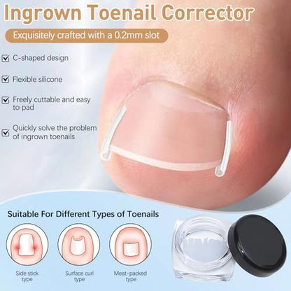 Ingrown Toenail Corrector Set with Correction Strips - Professional Pedicure Tool for Men and Women