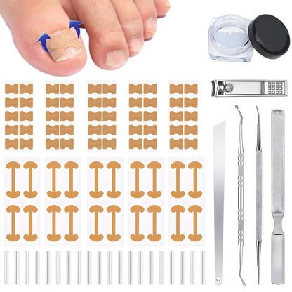 Ingrown Toenail Corrector Set with Correction Strips - Professional Pedicure Tool for Men and Women