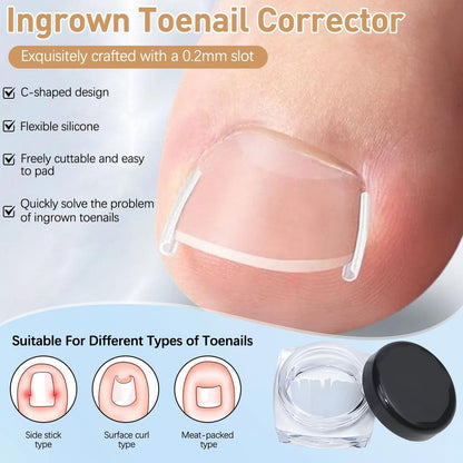 Ingrown Toenail Corrector Set with Correction Strips - Professional Pedicure Tool for Men and Women