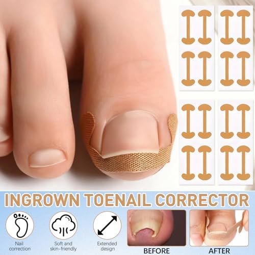 Ingrown Toenail Corrector Set with Correction Strips - Professional Pedicure Tool for Men and Women - görsel 10
