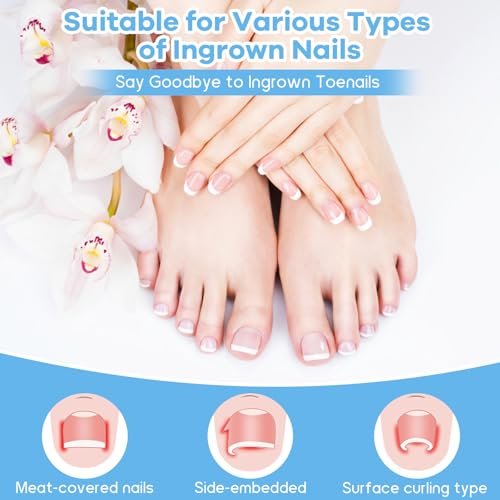 Ingrown Toenail Removal Kit with Corrective Strips, File, and Lifter – Maliyscent - görsel 10