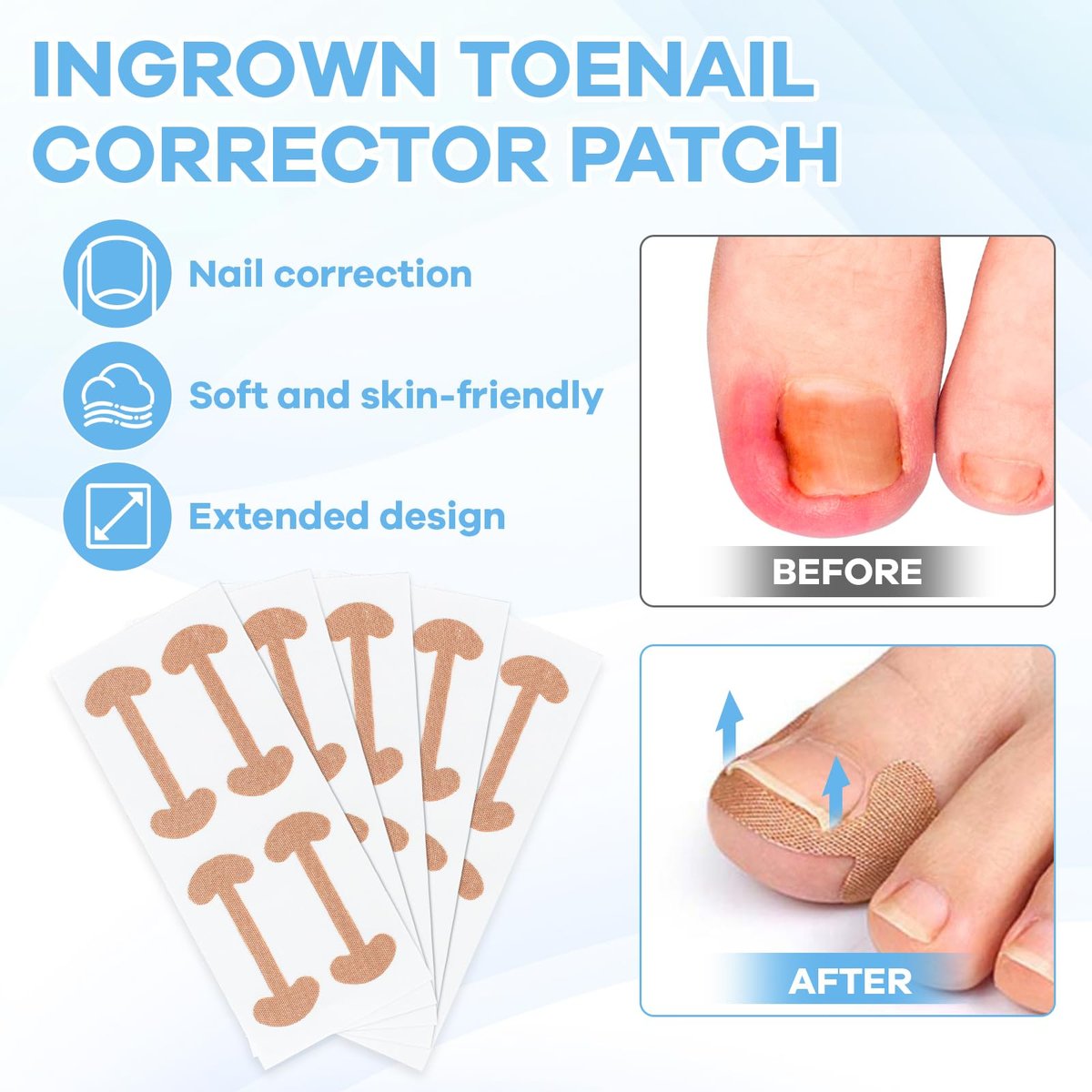Ingrown Toenail Removal Kit with Corrective Strips, File, and Lifter – Maliyscent - görsel 5