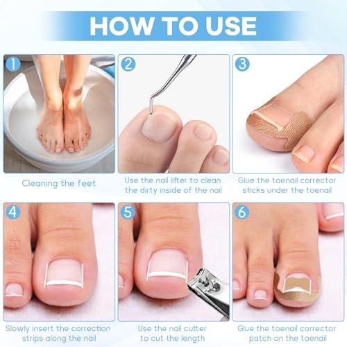 Ingrown Toenail Removal Kit with Corrective Strips, File, and Lifter – Maliyscent - görsel 8
