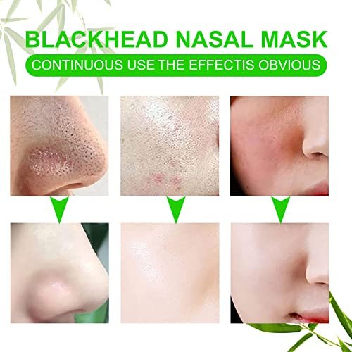 JWBVCTCR Pore Strips - Natural Charcoal Deep Cleansing Nose Strips for Blackhead Removal, 80 Count - görsel 14