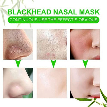 JWBVCTCR Pore Strips - Natural Charcoal Deep Cleansing Nose Strips for Blackhead Removal, 80 Count