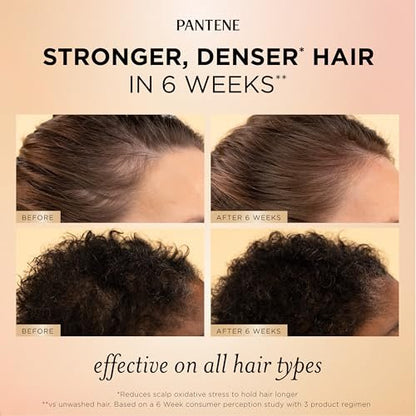 Pantene Abundant & Strong Daily Scalp Serum – Strengthen Roots & Reduce Hair Fall, 2 oz Avelisse