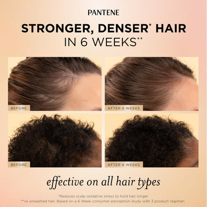 Pantene Abundant & Strong Daily Scalp Serum – Strengthen Roots & Reduce Hair Fall, 2 oz Avelisse
