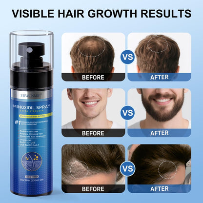 5% Minoxidil Spray for Men and Women - Extra Strength Hair & Beard Growth Treatment with Biotin, 7-Pack (11-Month Supply) Avelisse
