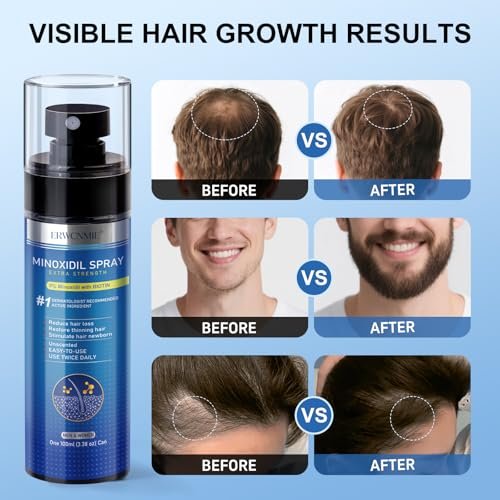 5% Minoxidil Spray for Men and Women - Extra Strength Hair & Beard Growth Treatment with Biotin, 7-Pack (11-Month Supply) Avelisse
