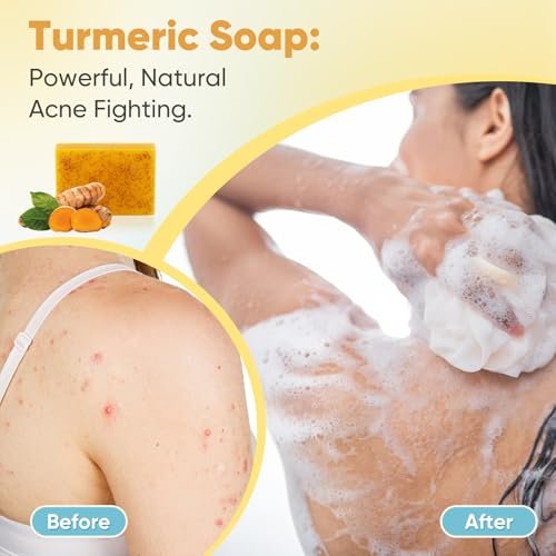 Treeroot Turmeric Soap 5 Pack - Kojic Acid Turmeric Soap Bar with Retinol, Collagen, Vitamin C & Shea Butter for Face & Body, SLS Free, 80g Each - görsel 10