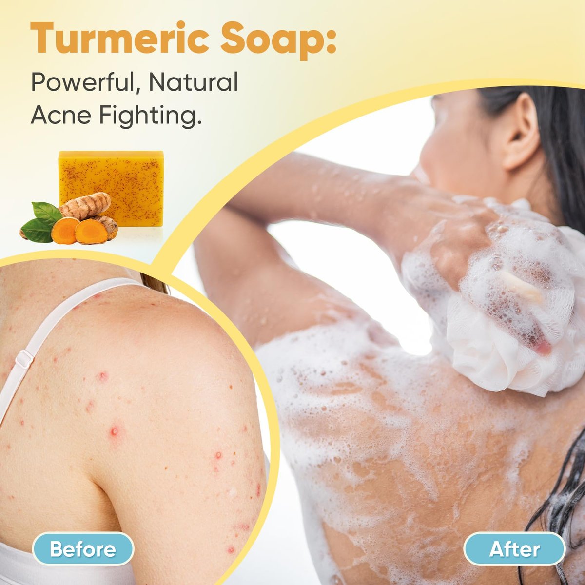 Treeroot Turmeric Soap 5 Pack - Kojic Acid Turmeric Soap Bar with Retinol, Collagen, Vitamin C & Shea Butter for Face & Body, SLS Free, 80g Each - görsel 9